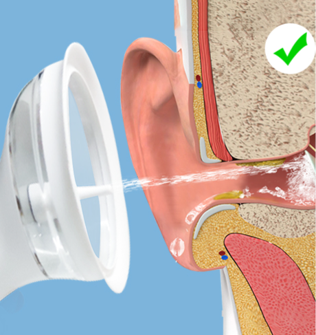 Ear Wax Removal (2025 Guide): Safe, Certified, and Effective Options That Work